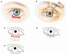 Barbarika Truth News India-image= April 23, 2026